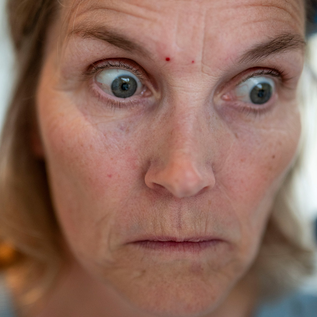 Sandra Smits, Donker verlicht | Leven met migraine